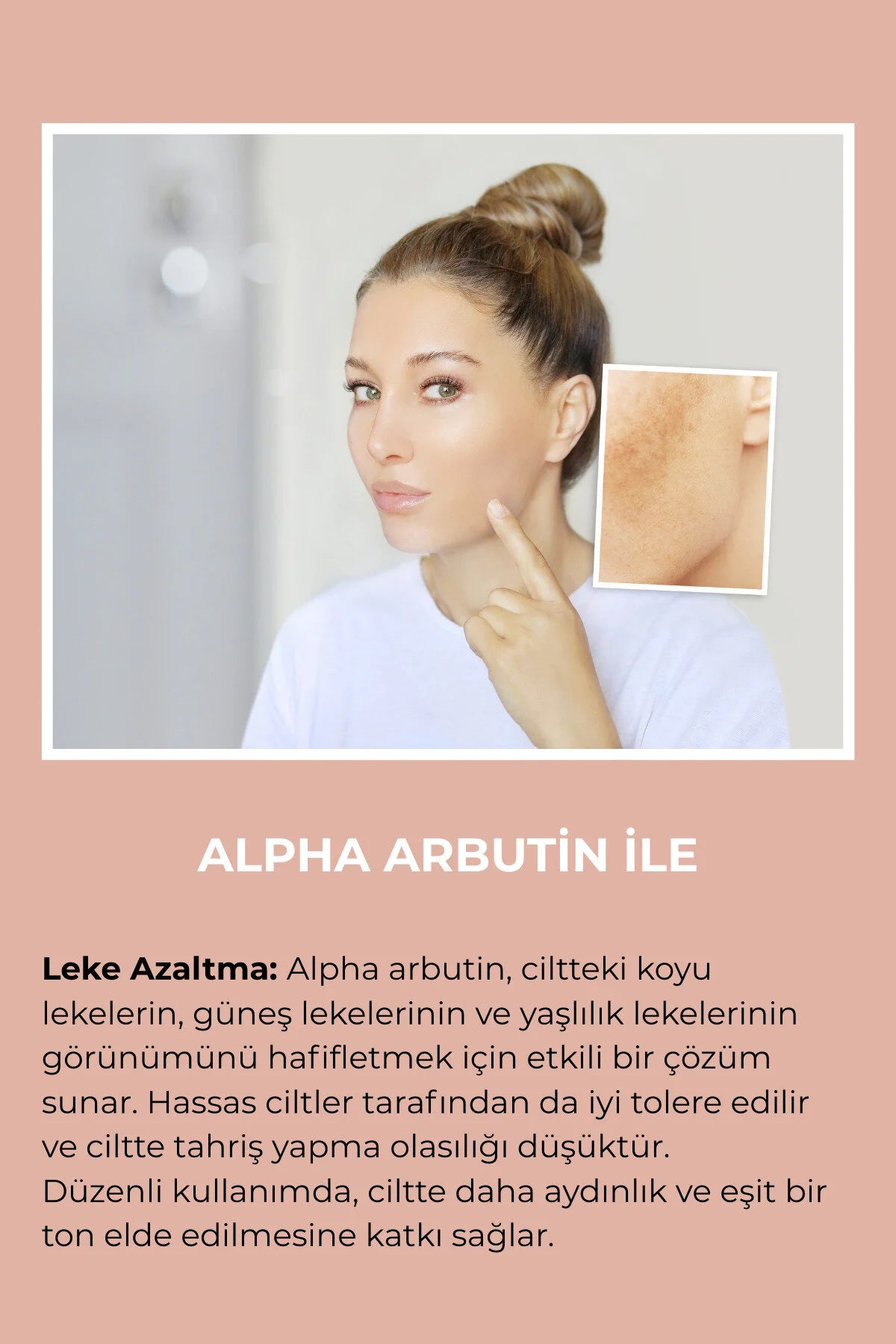 Alpha Arbutin İçeren Leke ve Aydınlatıcı Krem